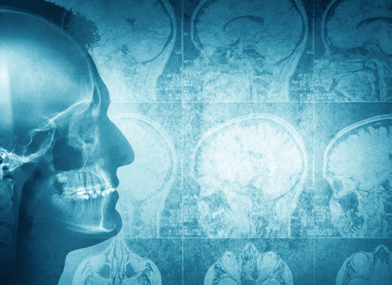 How Losing Obamacare Could Set Back County’s Mental Health Gains santa cruz mental health