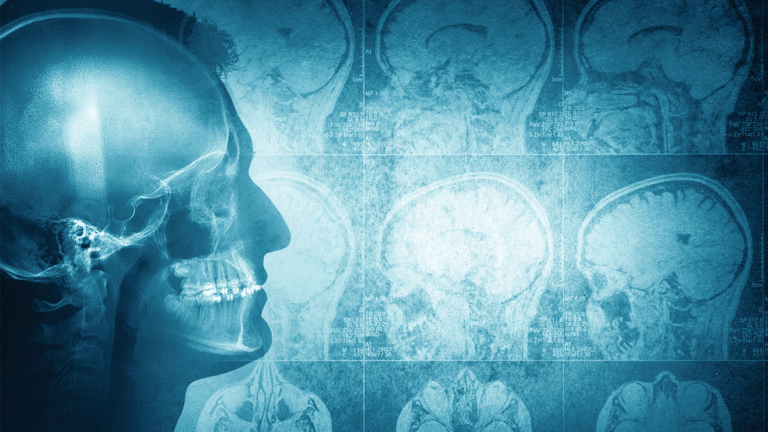 How Losing Obamacare Could Set Back County’s Mental Health Gains