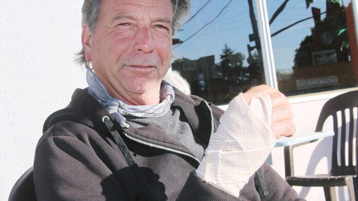 42 Stitches Later, Rio Theatre Owner Shares Dog Bite Realities