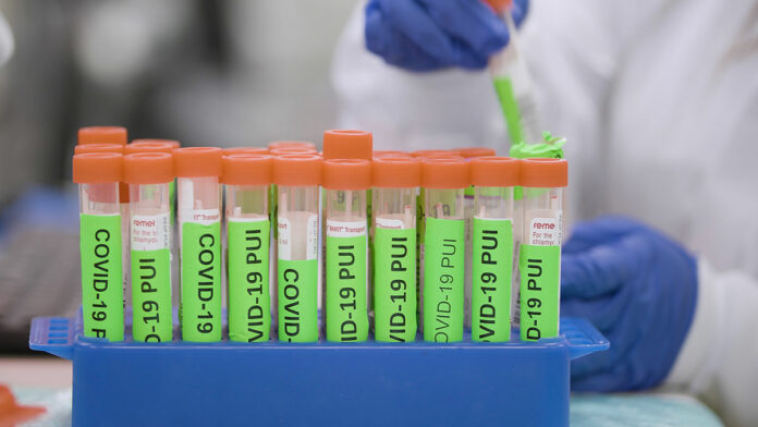 County Ramps Up Testing, Contact Tracing As Businesses Reopen