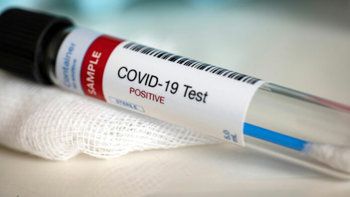 What You Need to Know About the Mutating Coronavirus Now in California